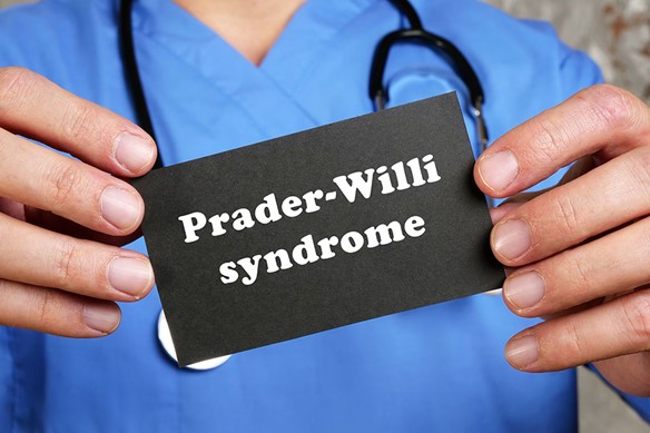 Prader-Willi Syndrome: Reasons, Signs, and Control