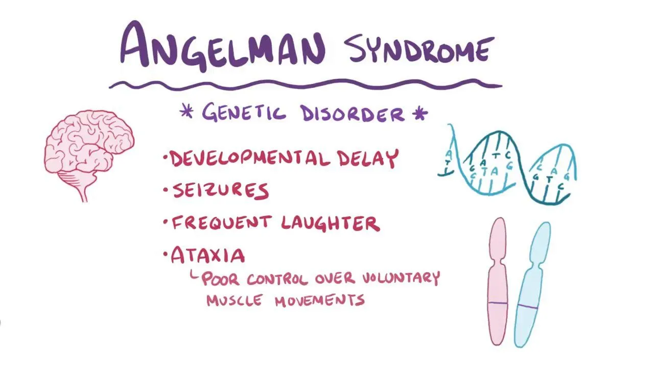 Angelman Syndrome: Reasons, Signs, and Treatment Options